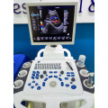 3D trolley color doppler ultrasound scanner machine with factory price